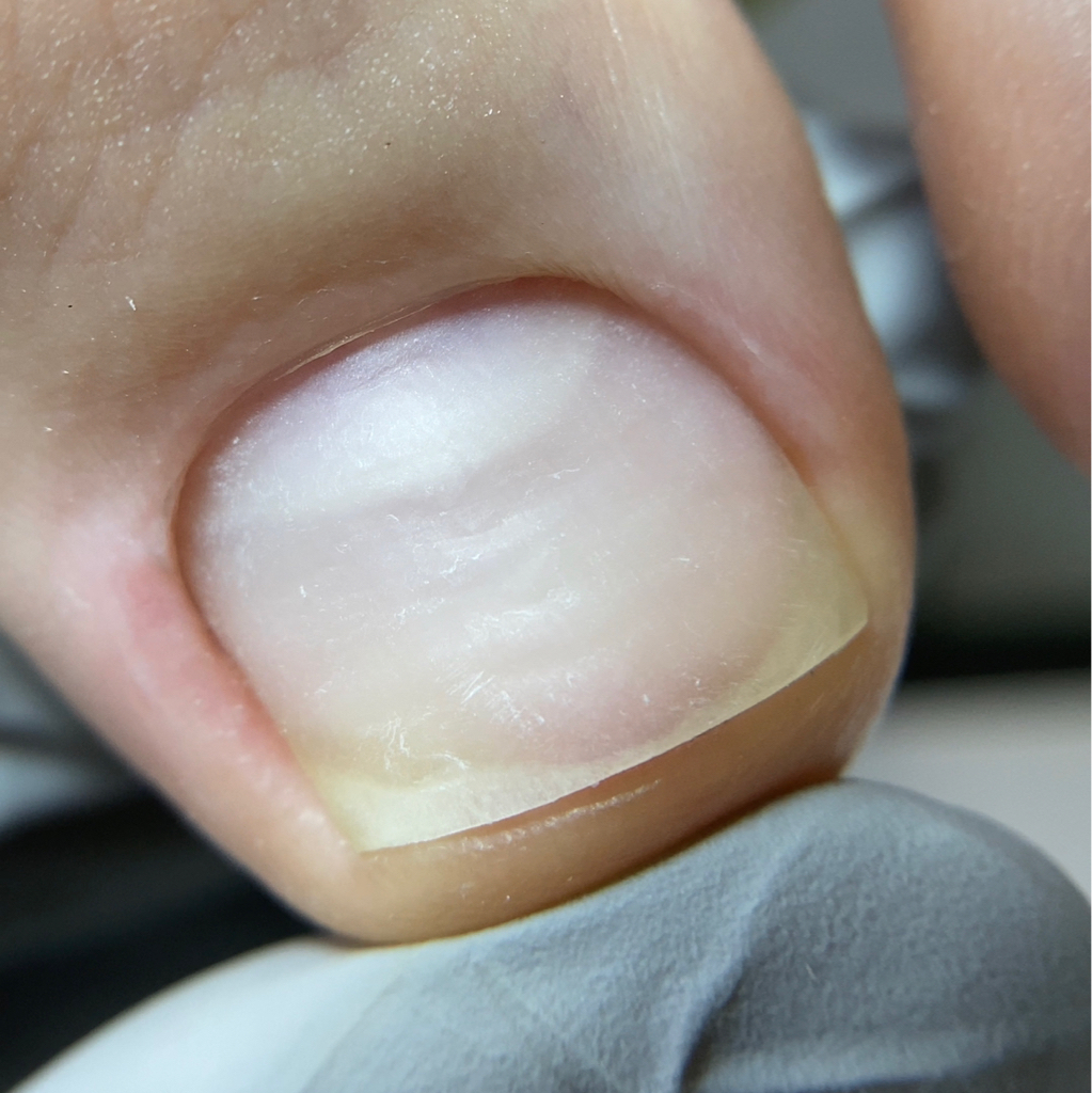 Обработка пальчиков (гигиена)