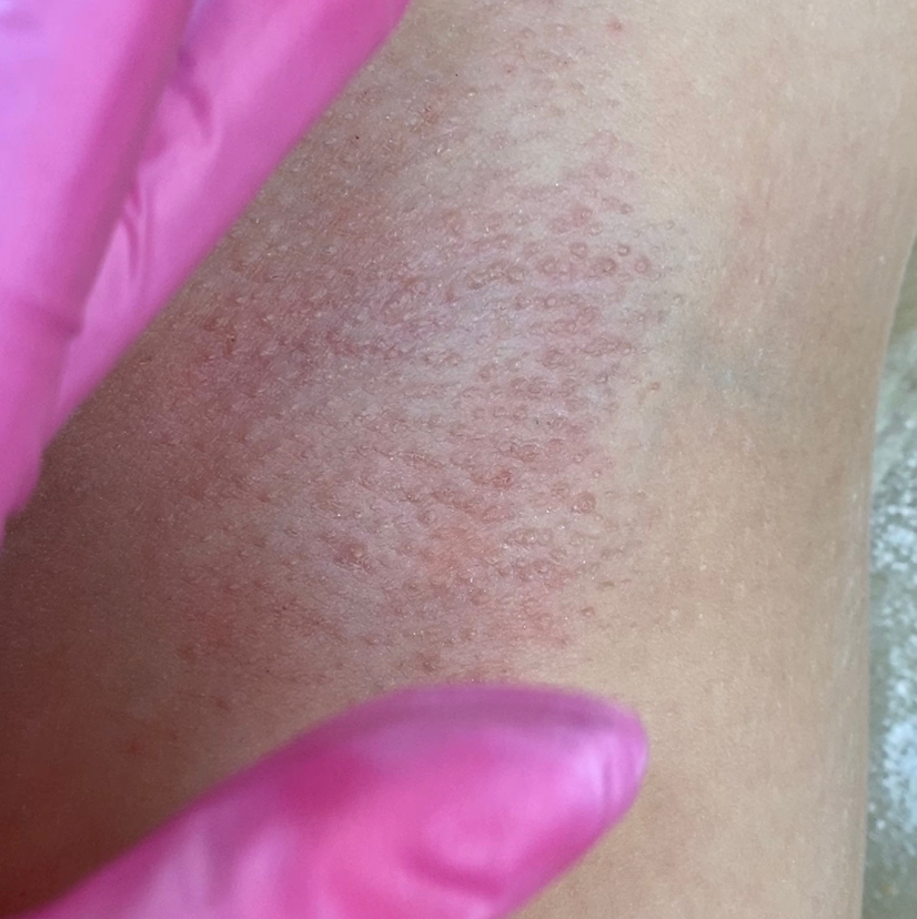 Подмышечные впадины