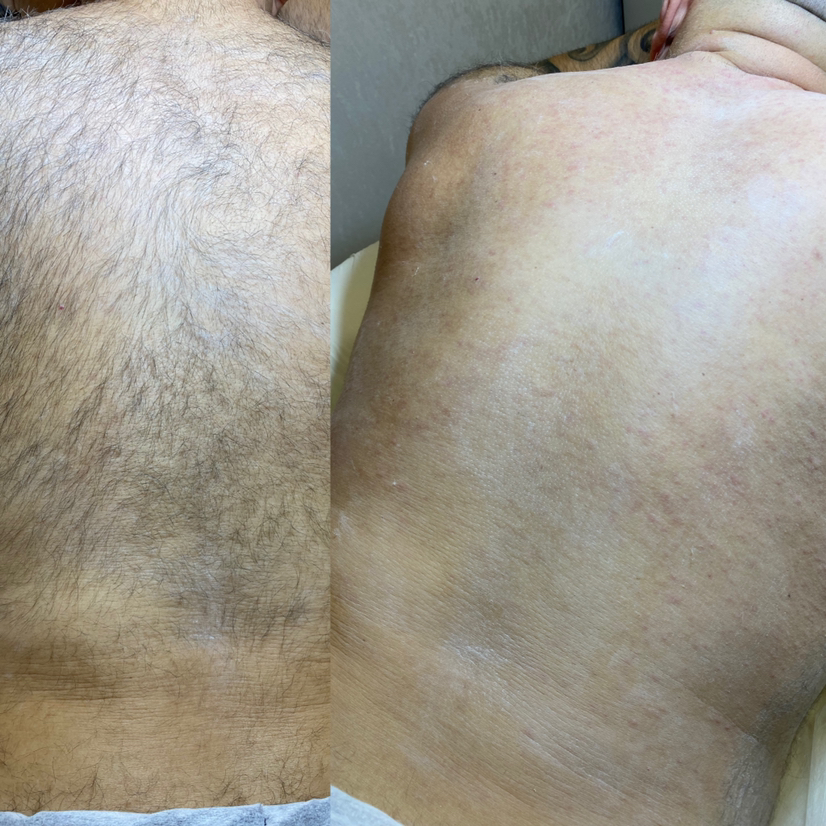 Мужчины. Спина полностью