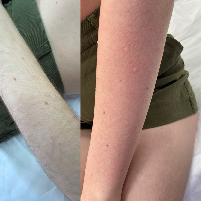 Руки до локтя