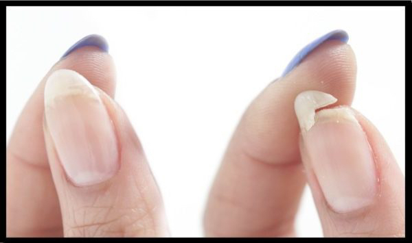 Ремонт 1 ногтя