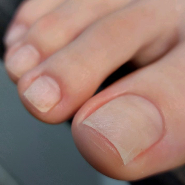 обработка пальчиков (педикюр)