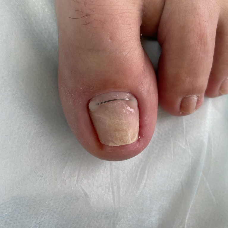 Коррекционная система