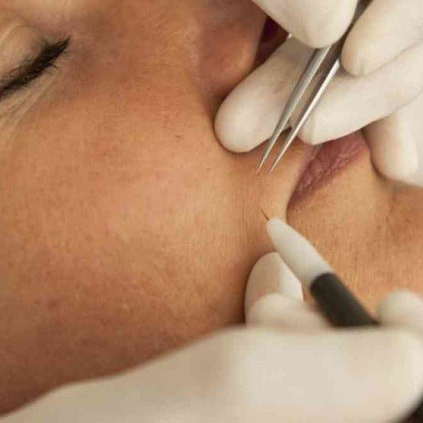 Усики ( верхяя губка)