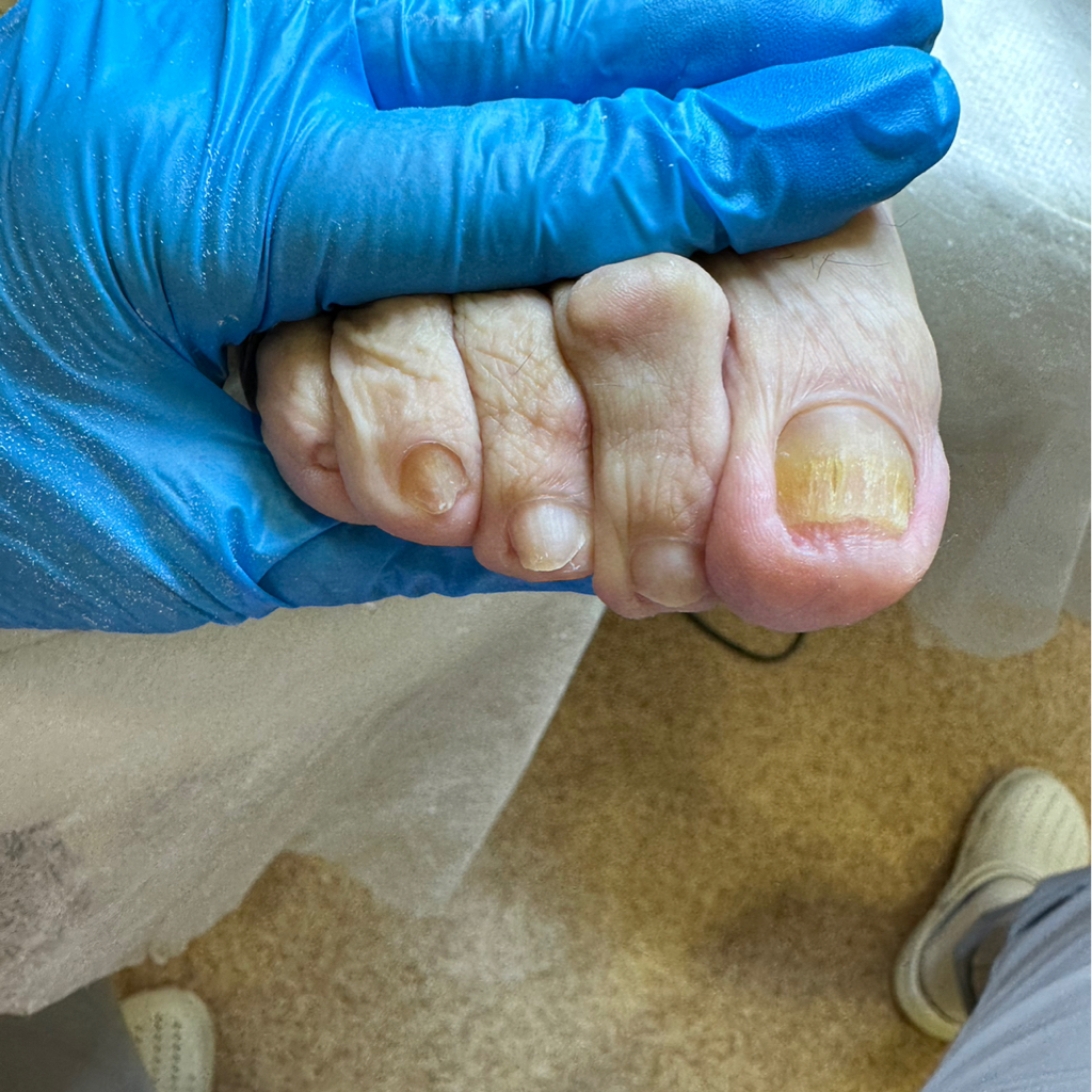 Лечебный педикюр Kart , 
1 визит