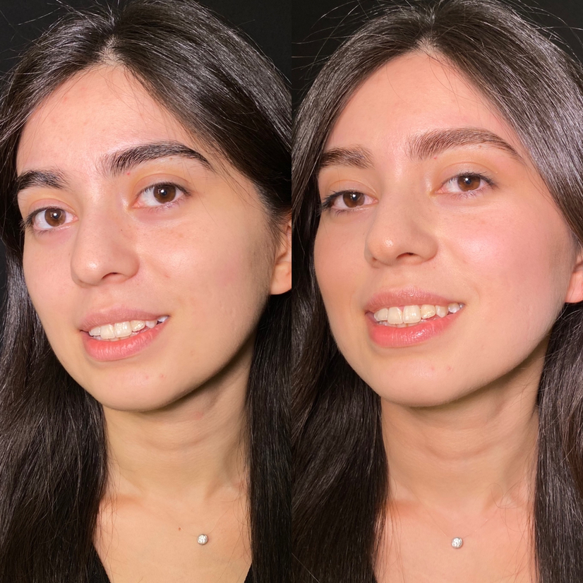 Комплекс «Осветление бровей»