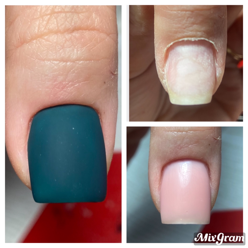 Донаращивание 1 ноготка