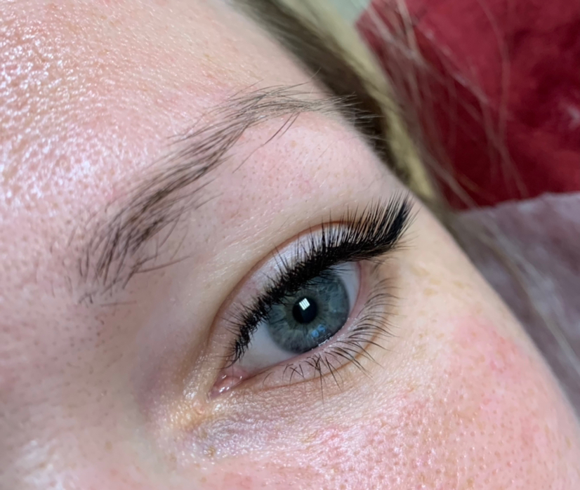 Лисий эффект