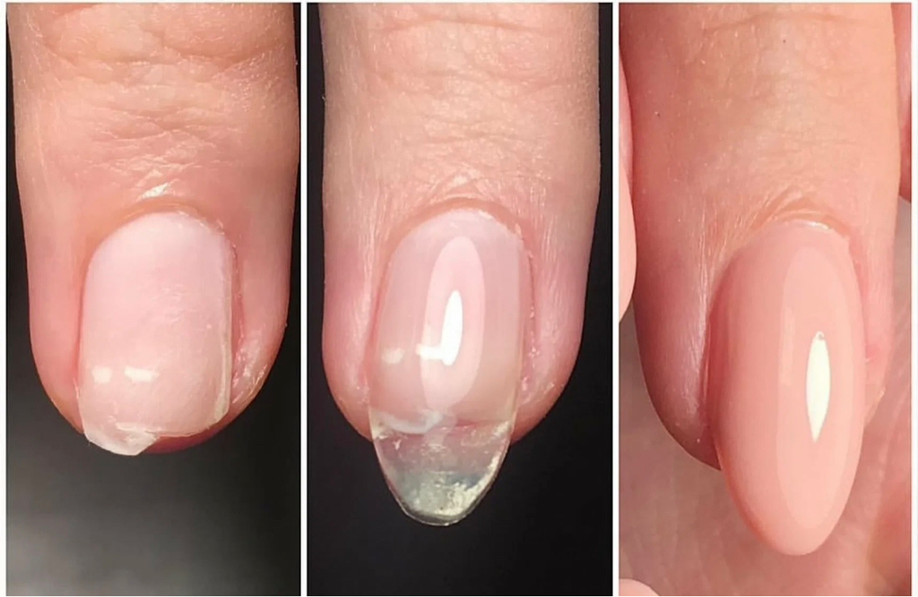 Ремонт ногтя, наращивание