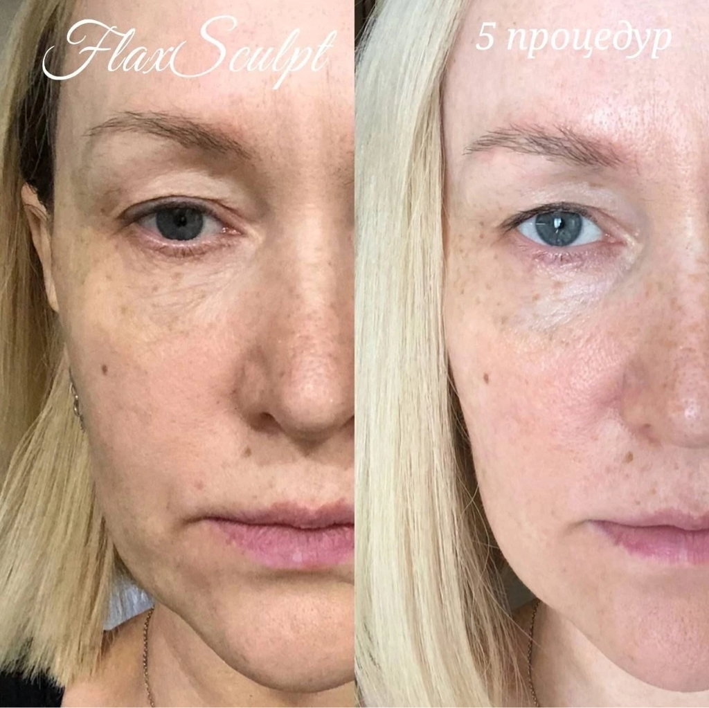 FlaxSculpt