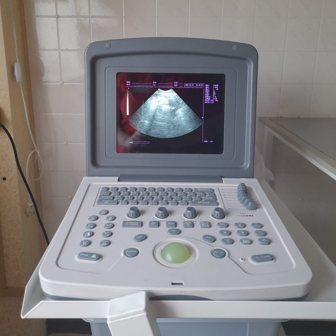 УЗИ на определение беременности