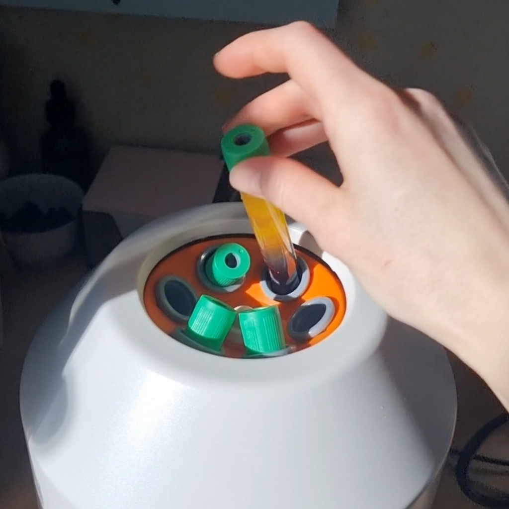 Плазмолифтинг Лица