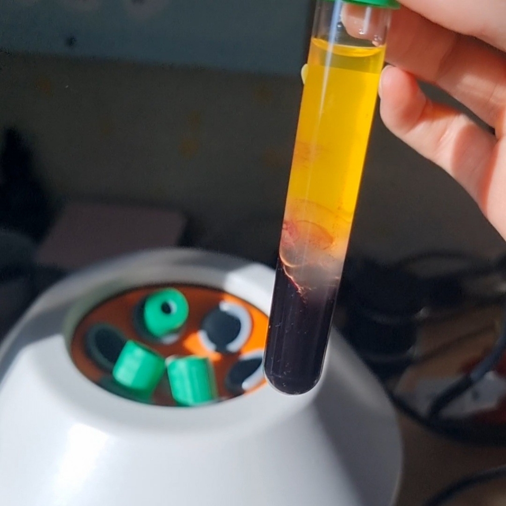 Плазмолифтинг Волос