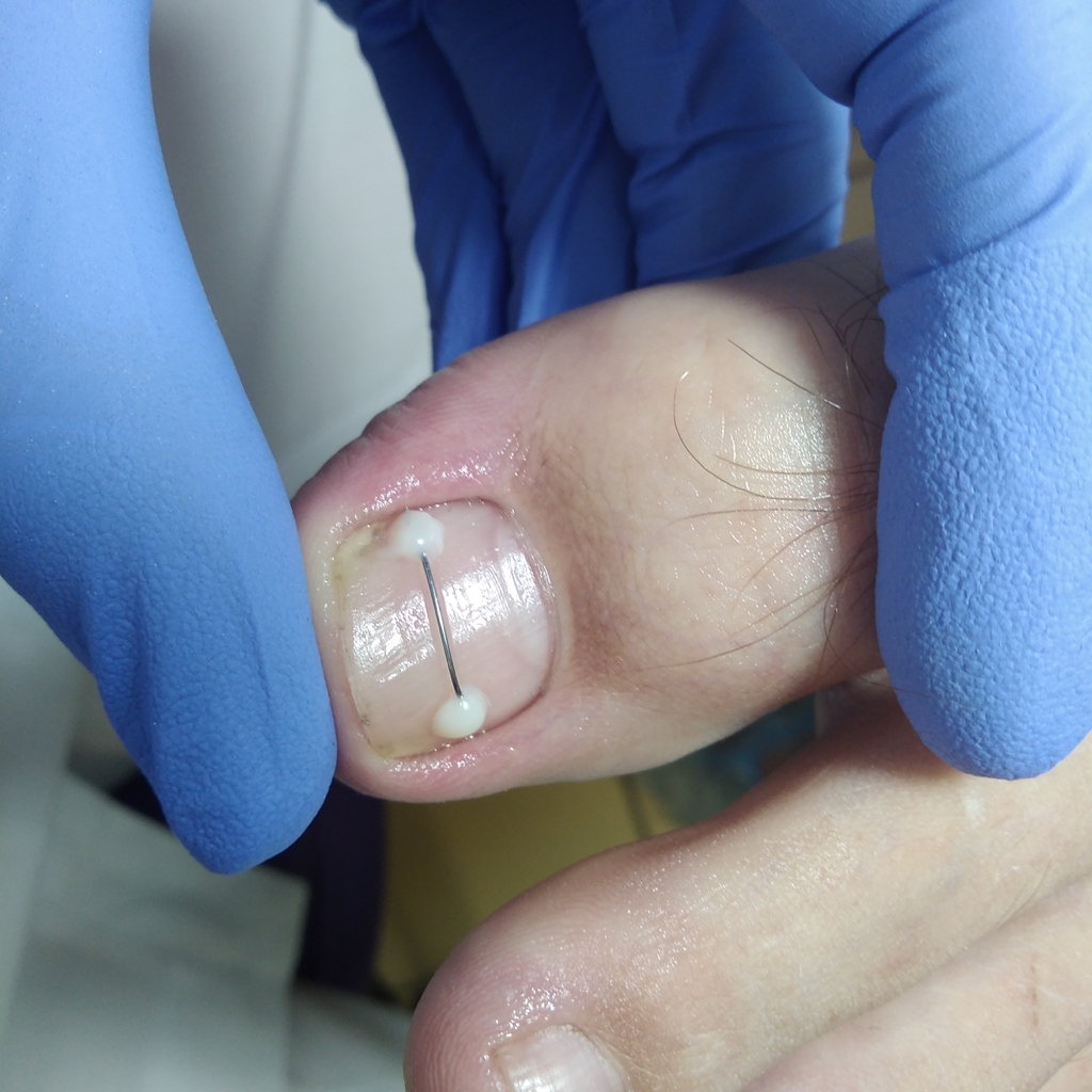 Установка системы « Т . нить» 1 ед