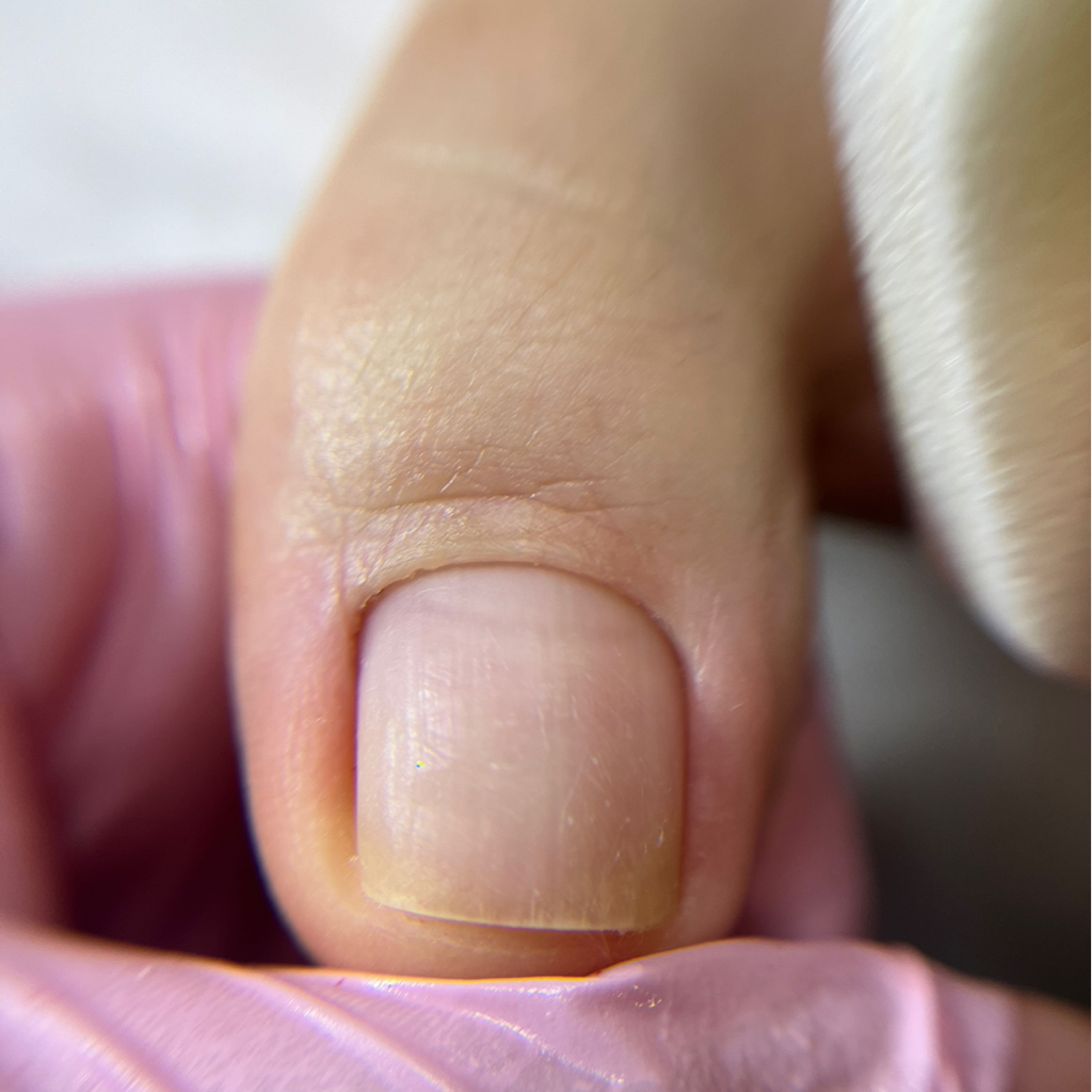 Педикюр  гигиеническая обработка пальчики