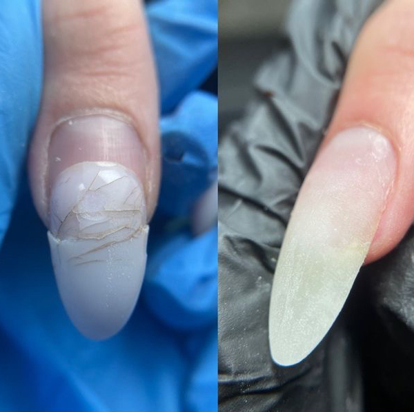 Ремонт ногтя