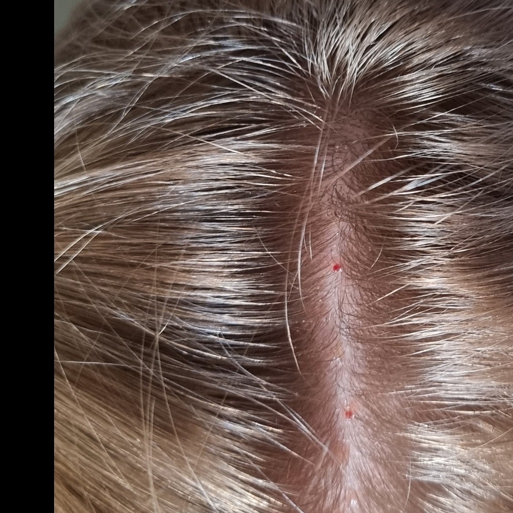 Мезотерапия волос Mesopharm hairX Vita B витаминный комплекс