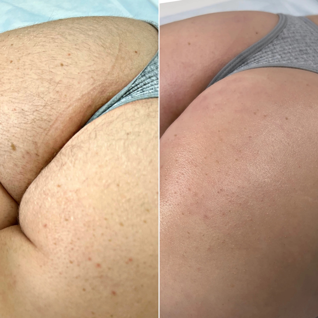 Ягодицы( воск)