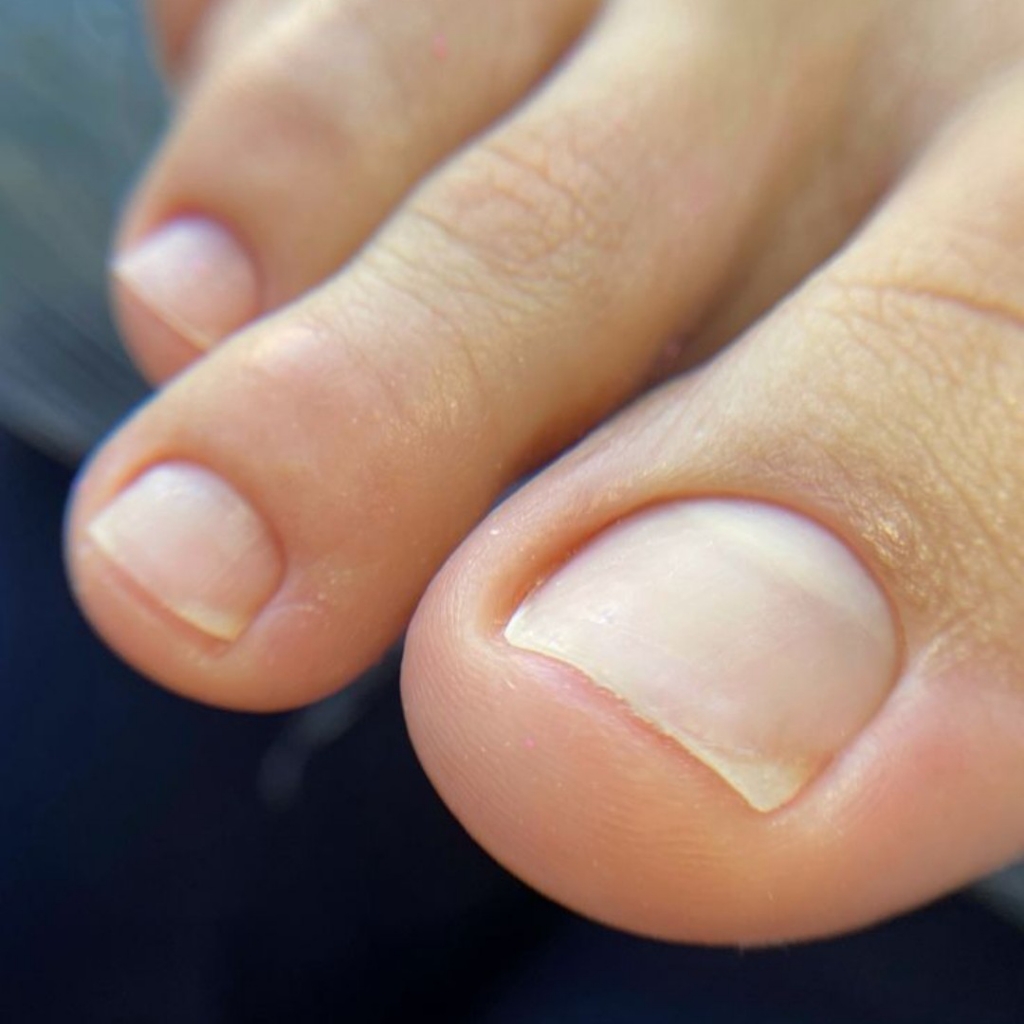 Педикюр (обработка пальцев)