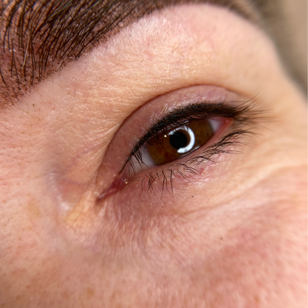 ПМ межресничка