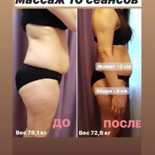 Массаж ручной антицеллюлитный.