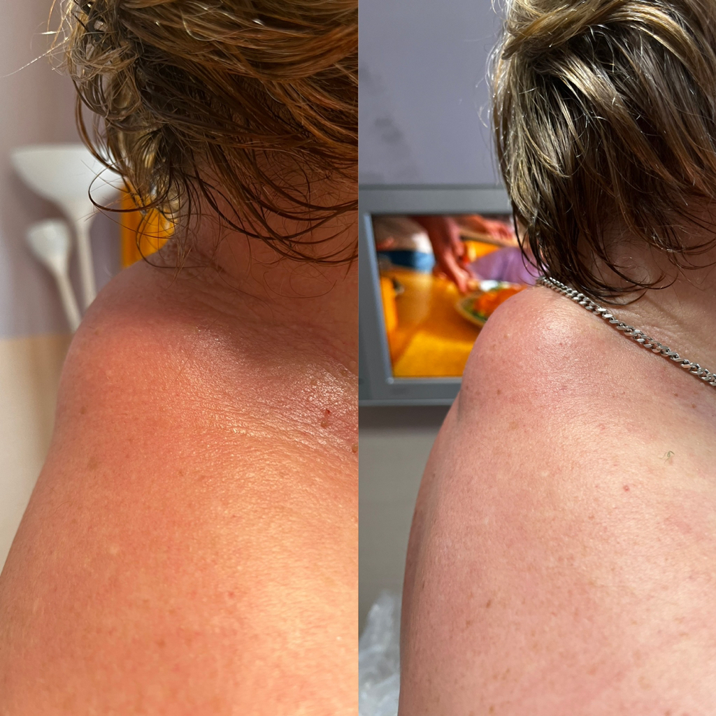 Массаж шейно-воротниковой зоны