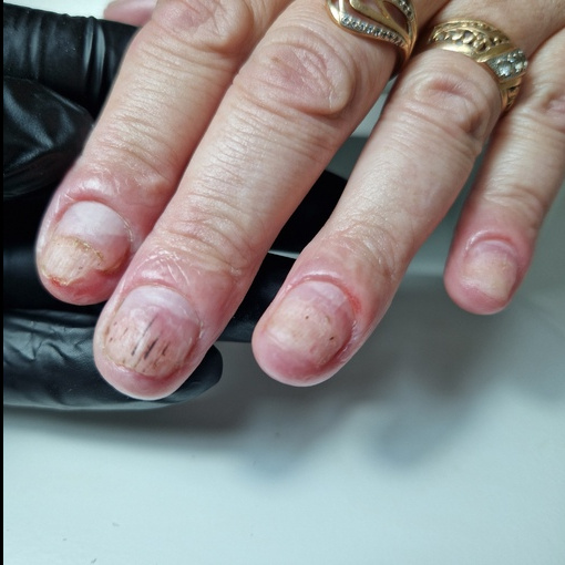 Подологический маникюр