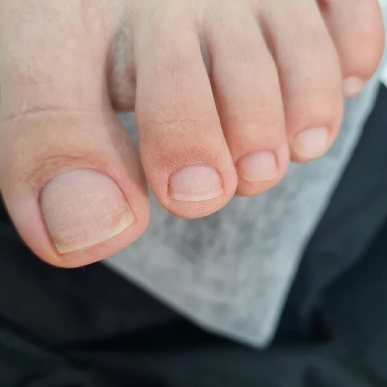 Педикюр: гигиеническая обработка пальцев ног