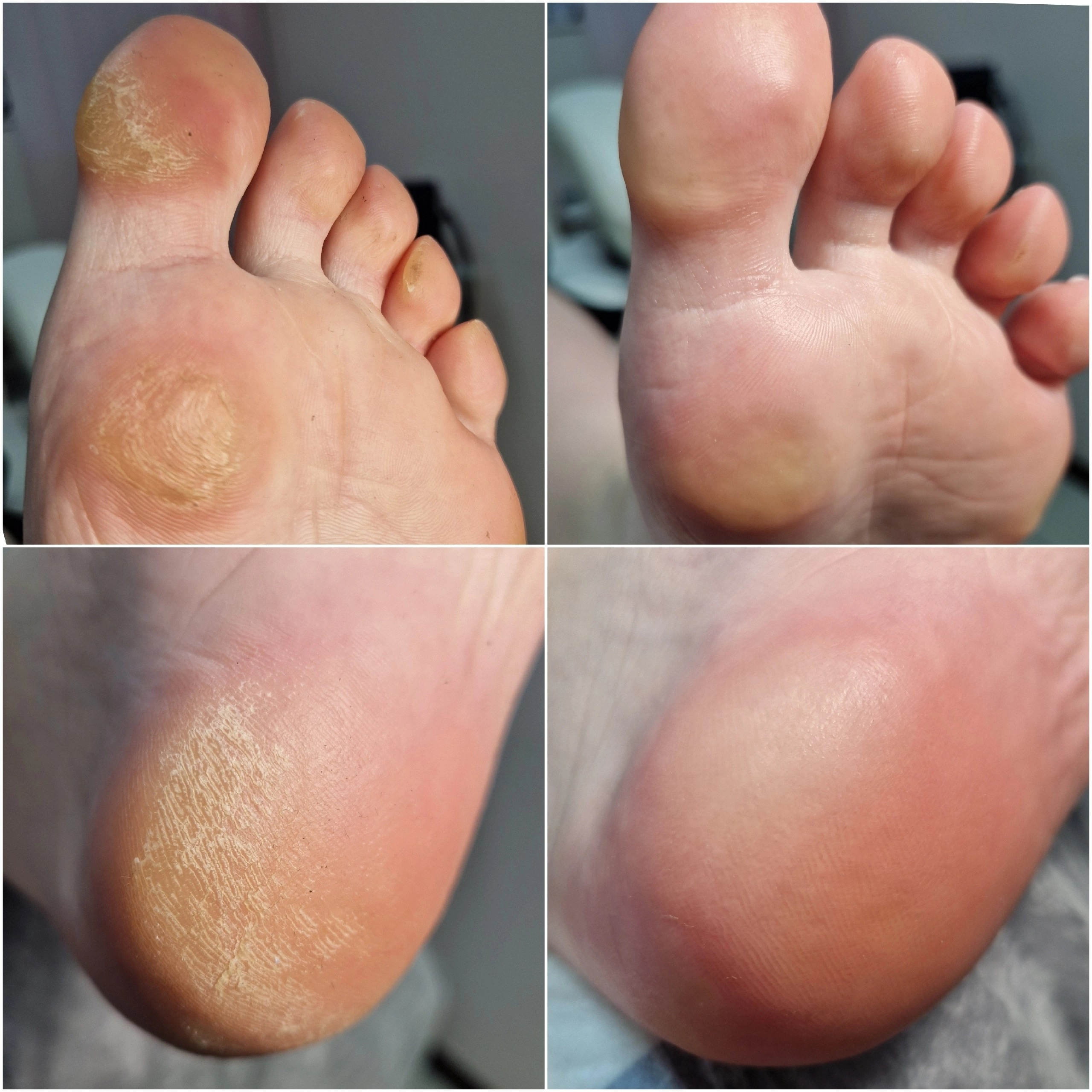 Педикюр гигиенический полный