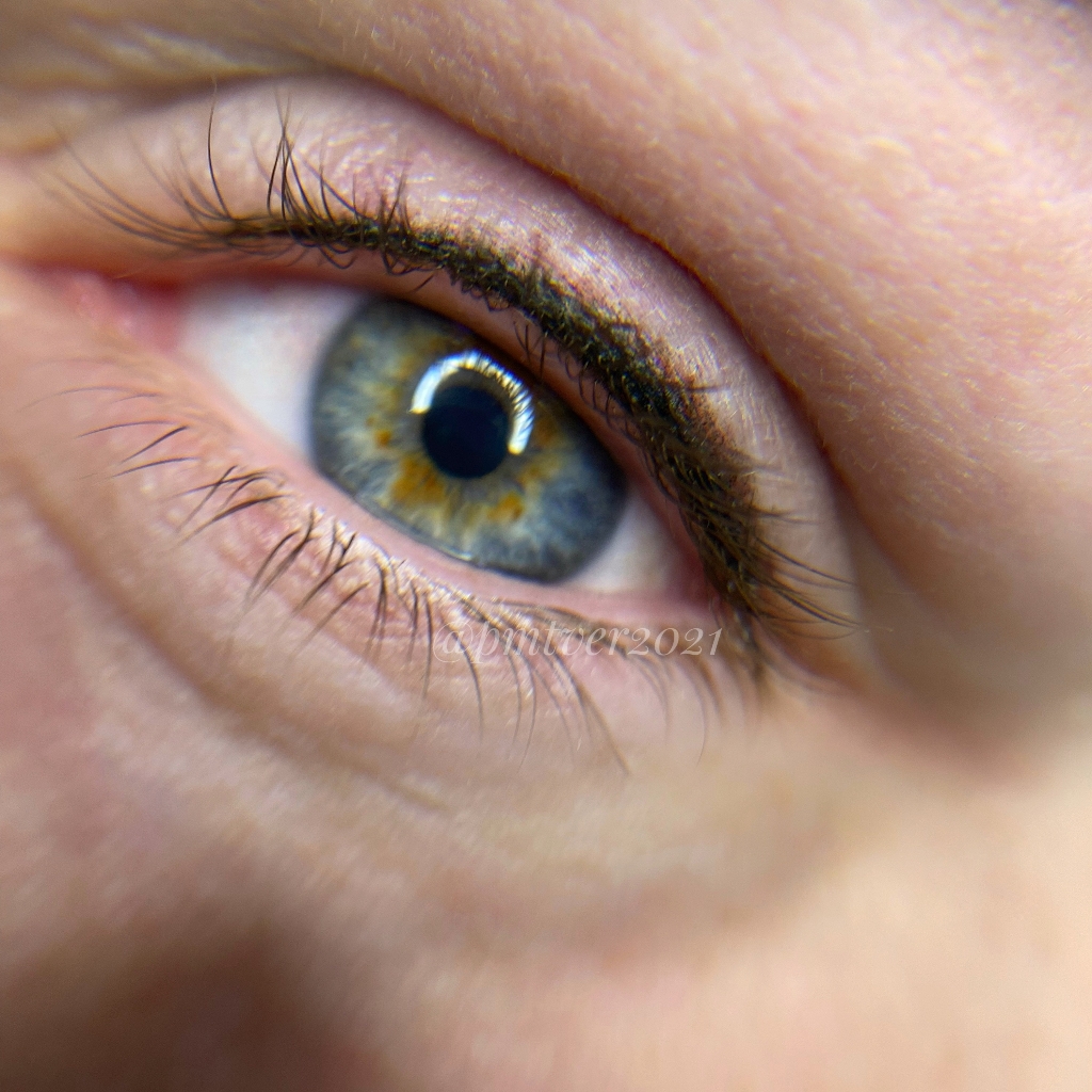 Межресничка