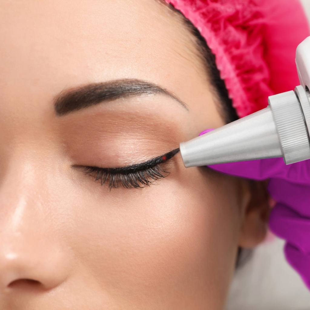 Удаление ПМ стрелочка