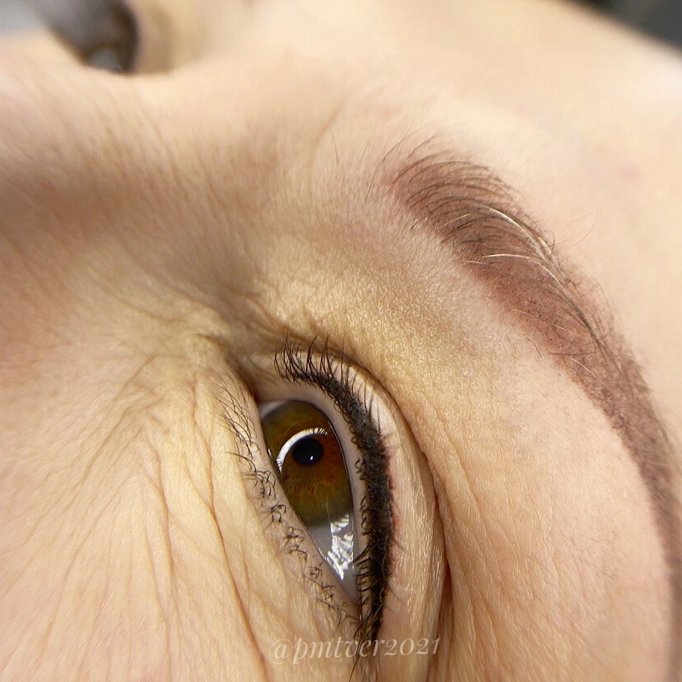 Коррекция межресничка