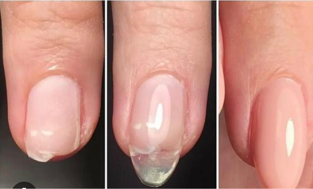 Ремонт одного ногтя