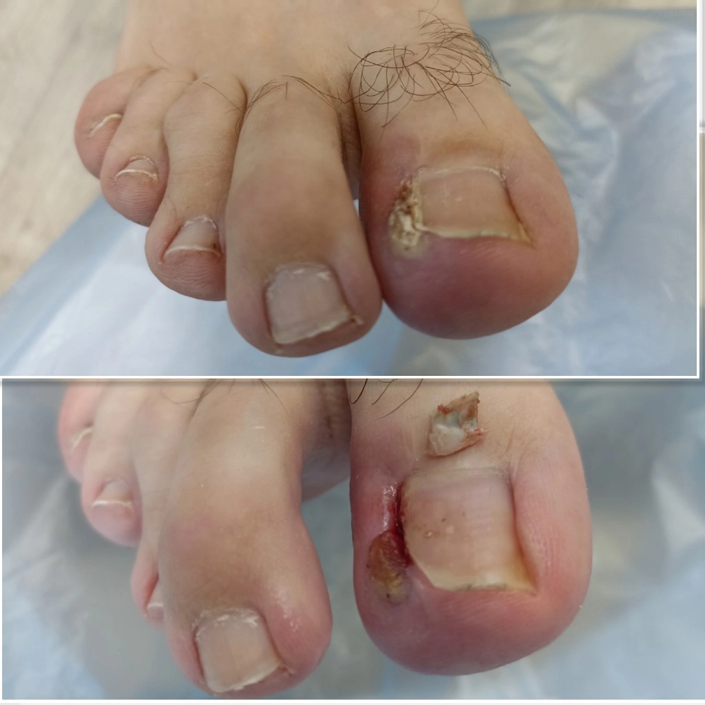 Обработка одной проблемной зоны