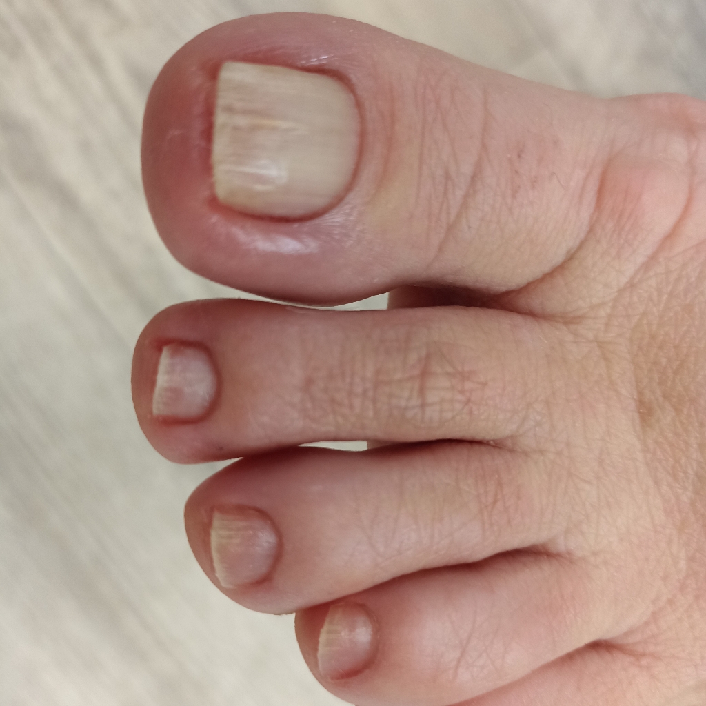 Чистые пальчики. Эстетика