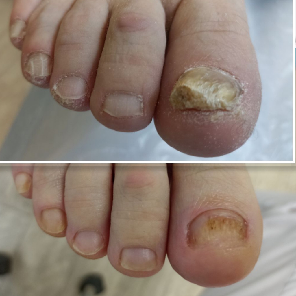 Чистые пальчики. Подология