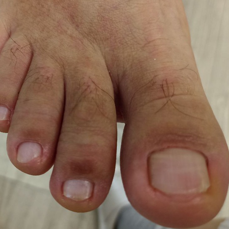 Мужской педикюр. Эстетика