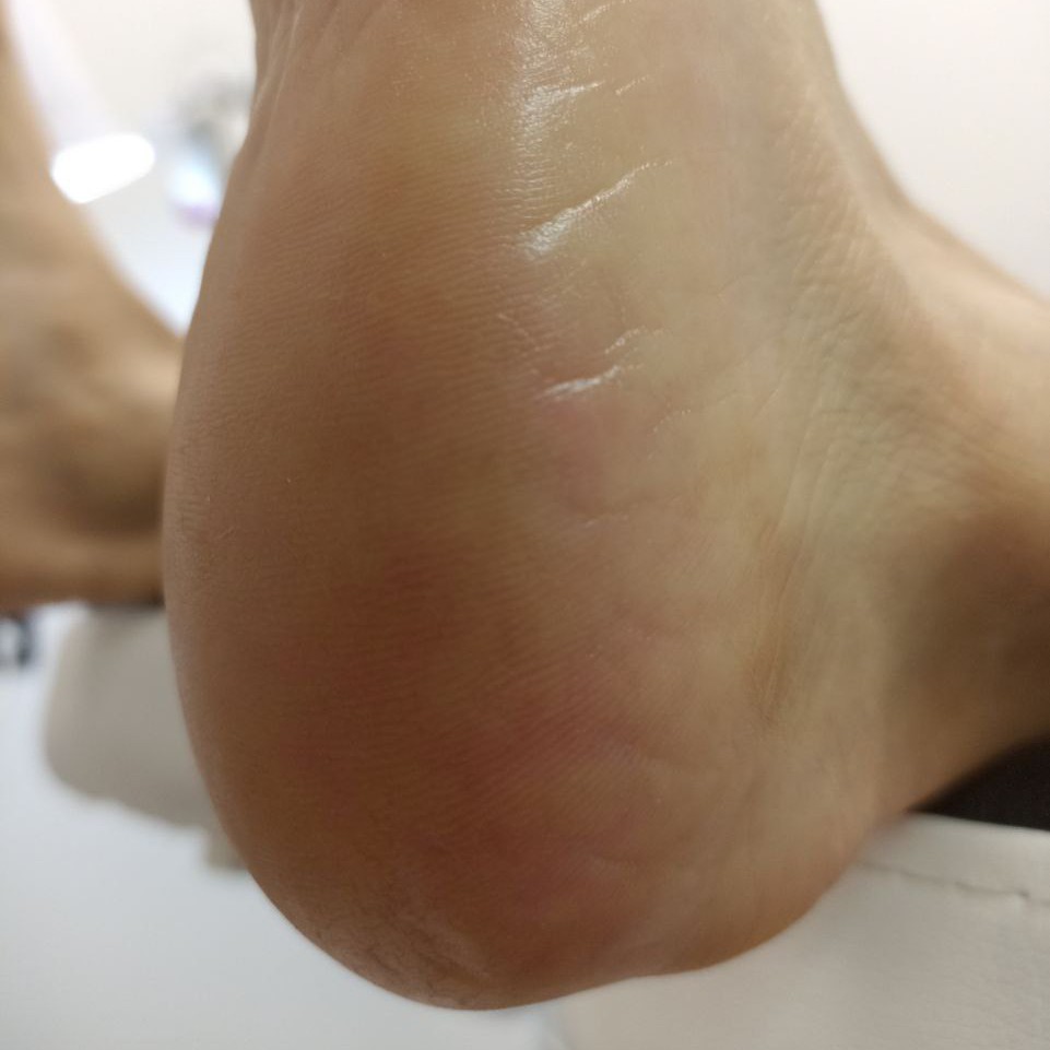 Педикюр. Эстетика.