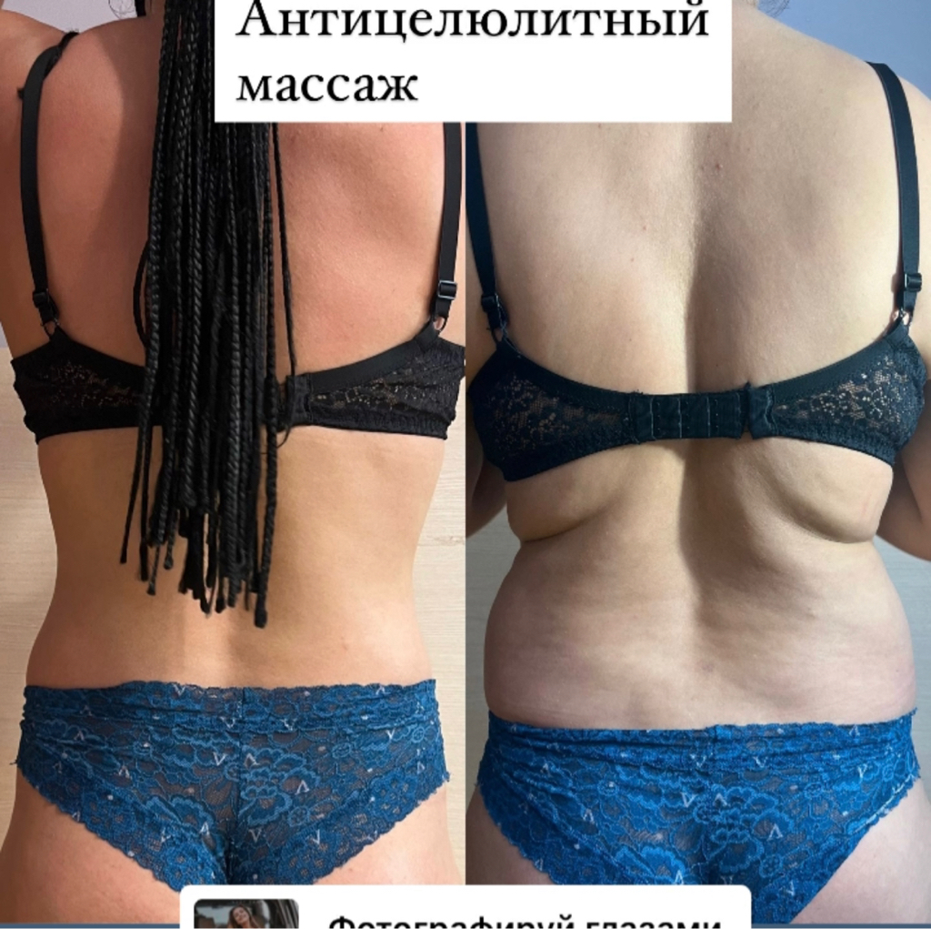 Массаж аппаратный антицеллюлитный.
