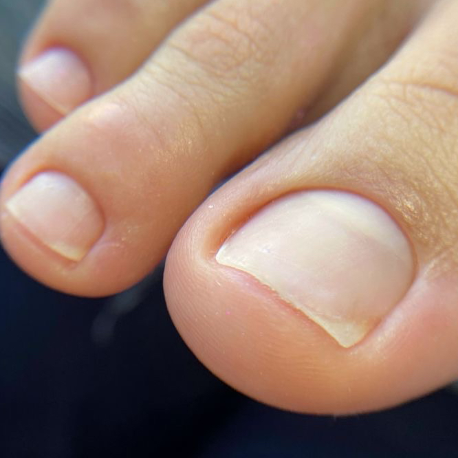 Педикюр. Обработка пальцев без покрытия