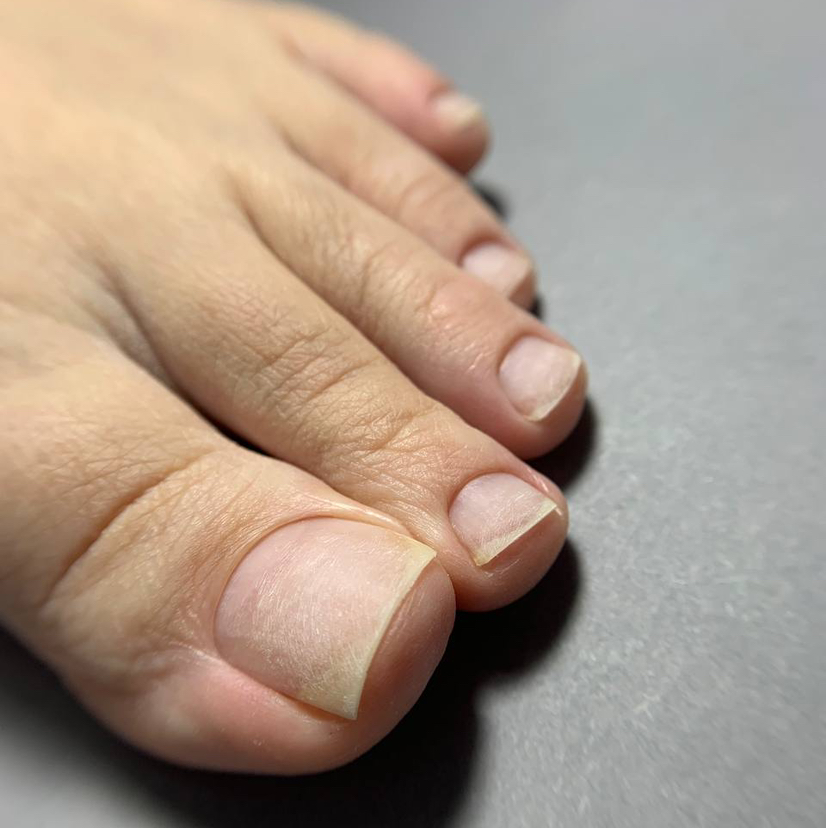 Обработка пальцев (ТОП-мастер)