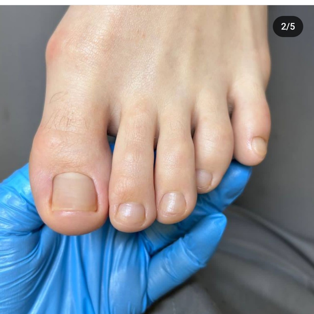 Обработка пальцев ног