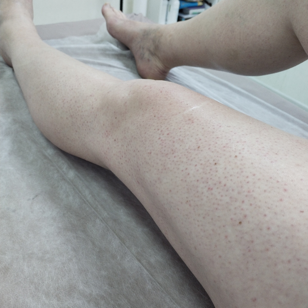 ноги полностью