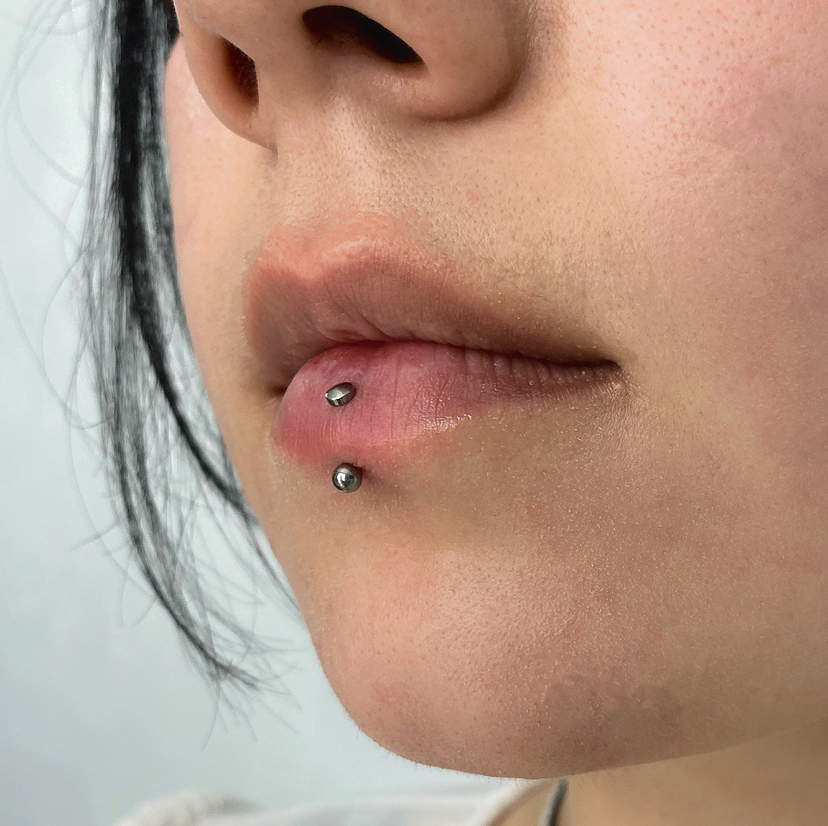 Вертикальный лабрет