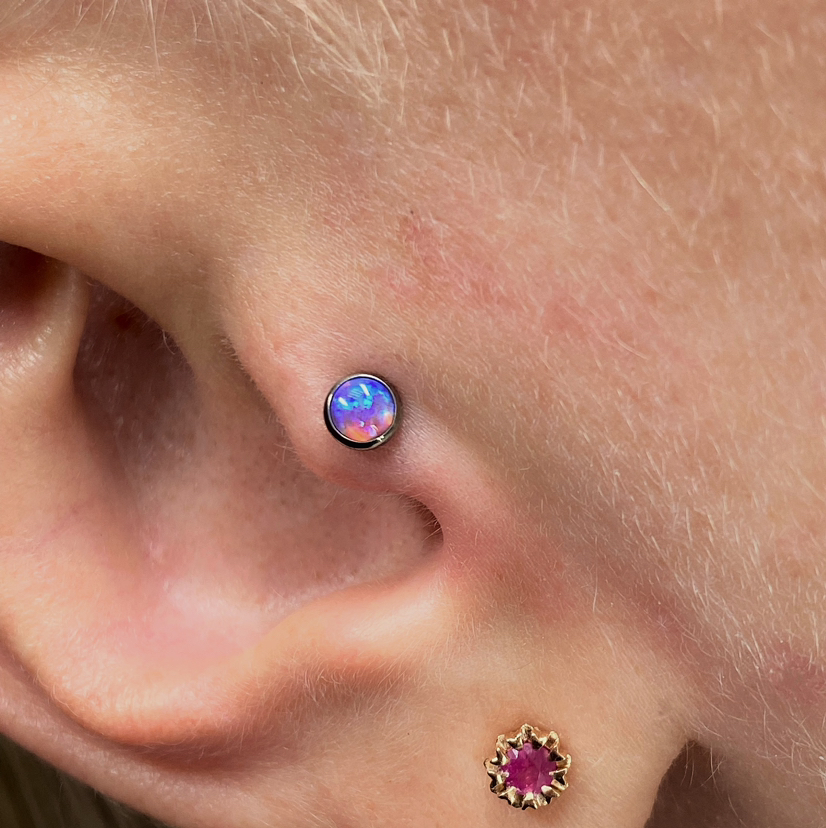 Трагус (козелок)