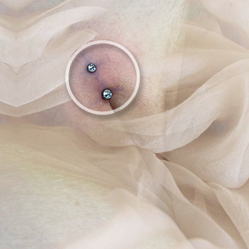 Женский интимный прокол