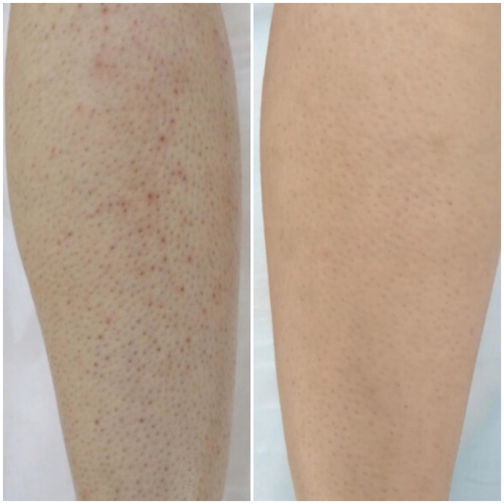 Голени с коленями