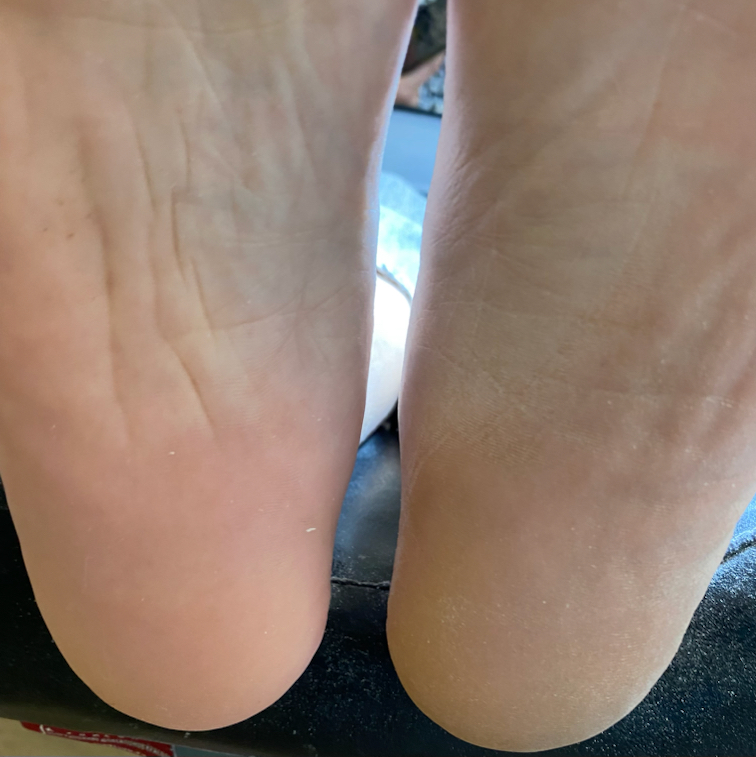 Педикюр Аппаратный