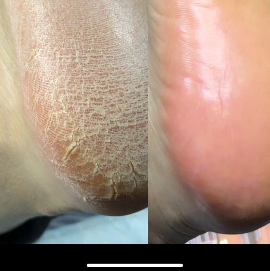 Smart педикюр с однотонным пркрытием