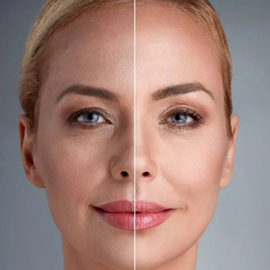 Лазерное омоложение